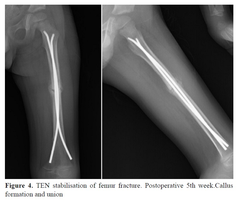 GPC Medical Ltd. | Orthopedic Implants Industry in India - Market Overview,  Industry Reports & Forecast | Page 3