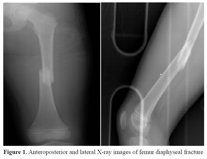 Tens | PDF | Anatomical Terms Of Location | Arm