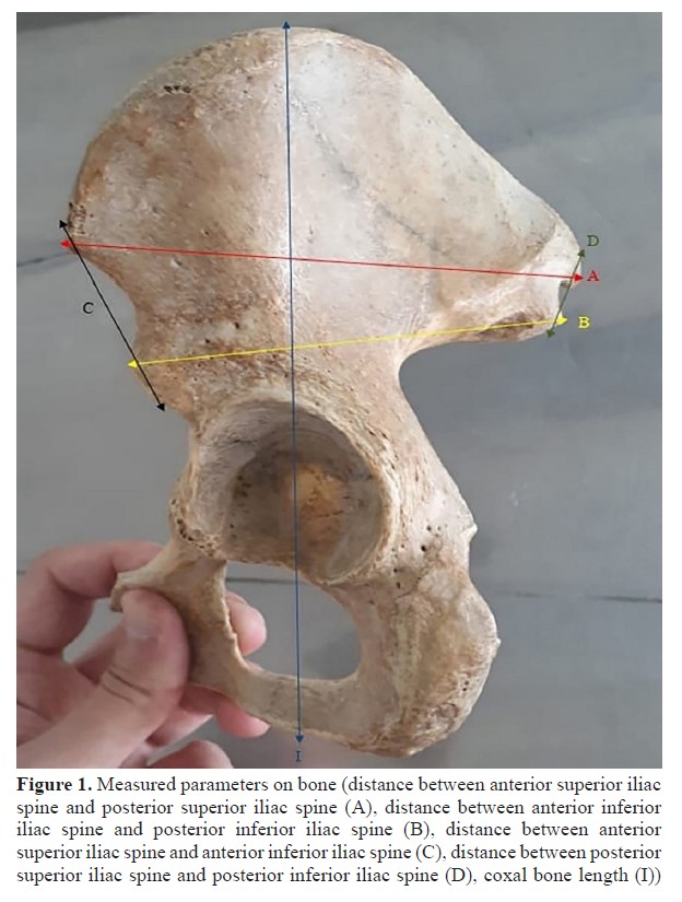 Medicine Science  The mystery of morphometric measurements of the coxal  bone